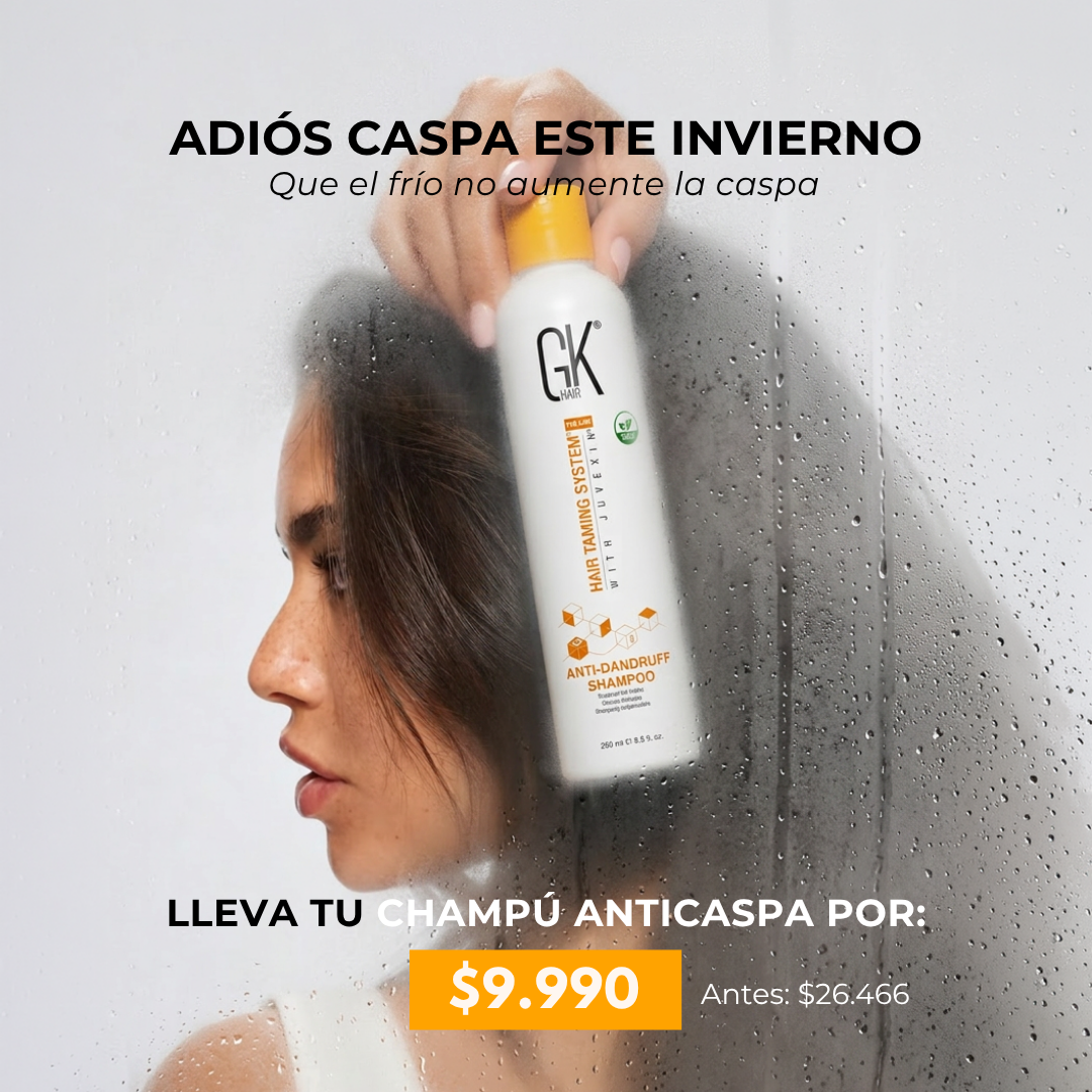 Adiós Caspa este Invierno
